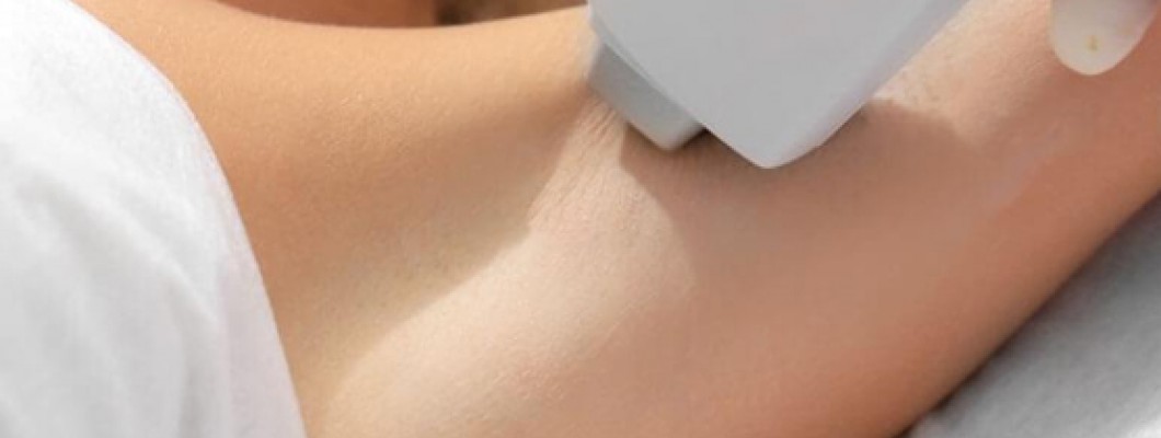 Diode Lazer Epilasyon Çeşitleri